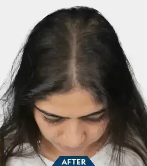 Patient Case 1 after treatment