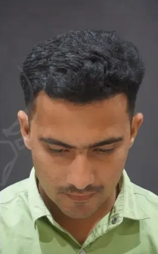Patient Case 3 after treatment