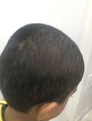 Patient Case 4 after treatment