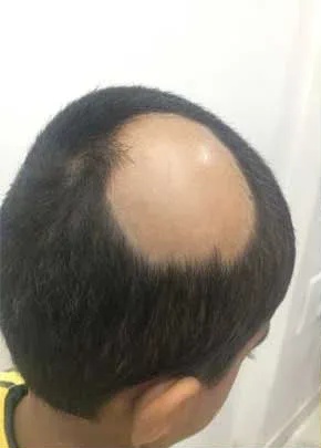 Patient Case 4 before treatment
