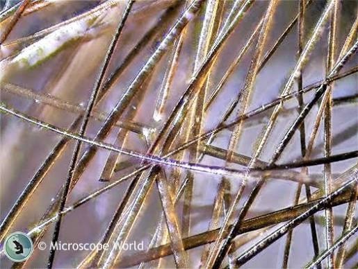 High-magnification analysis of hair shafts under incident toplight microscopy