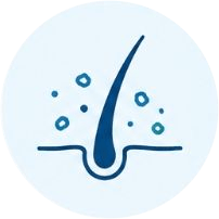 Dandruff — hair fall root cause factor